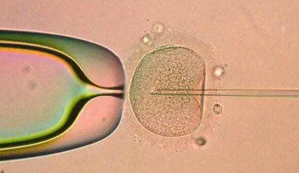 无锡第三方助孕 2022无锡卵巢早衰做试管包成功医院最新排名。 ‘3个月彩超怎