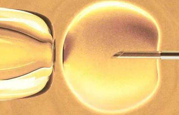 重庆知名助孕成功率 2022年在重庆妇幼保健院做供卵试管排队吗? ‘胎儿nt单男女